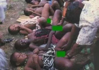 The cruel custom of "circumcision" in Africa1
