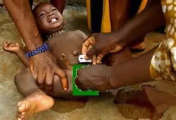 The cruel custom of "circumcision" in Africa2