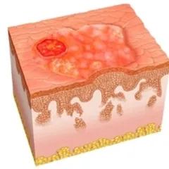 Taiwan Ivana Imported Yoga Mat (Dream Orange Flower)