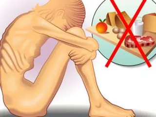 To meet office workers 'four big wishes to lose weight, choose diet or exercise?