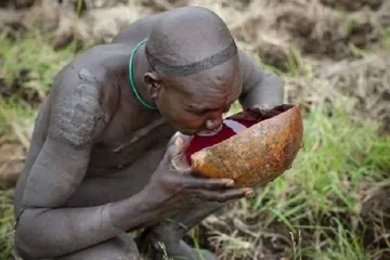 Check out 8 strange diseases6