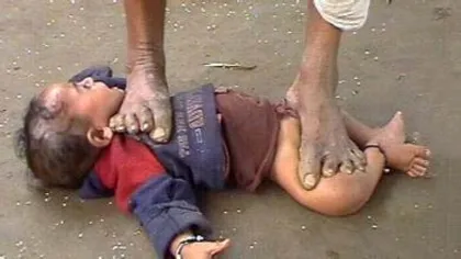 India is another absurd and strange customs that shocked the world: cruel witch doctors step on children to treat their sore throats