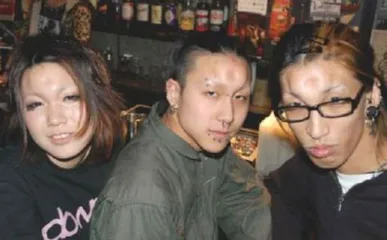 Japanese youth popular strange plastic surgery "bagel head" modeling2