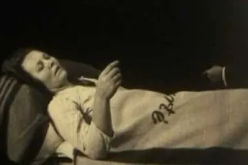 Eight weird epidemic diseases in the world