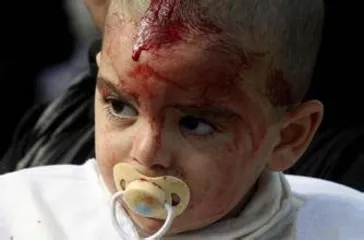Shiite Muslim traditional custom "Ashura": bloody cuts the scalp3