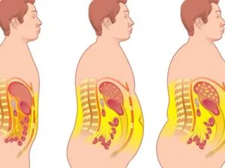 How to treat fatty liver? Drink two kinds of porridge often to eliminate it!