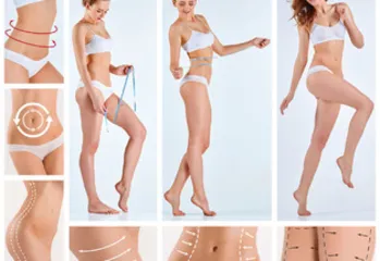 10 ways to lose weight, yoga, create the perfect hip shape9