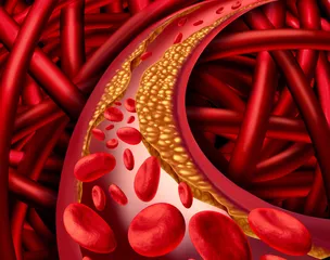 Fat gain in middle age becomes the norm! Four health risks are creeping around you, don